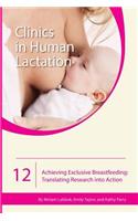 Achieving Exclusive Breastfeeding