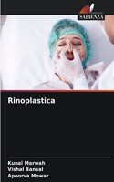 Rinoplastica