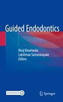 Guided Endodontics