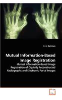 Mutual Information-Based Image Registration