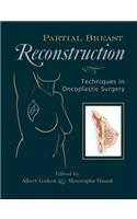Partial Breast Reconstruction: Techniques in Oncoplastic Surgery