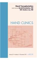 Hand Transplantation, an Issue of Hand Clinics