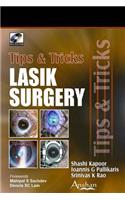 Lasik Surgery: Tips and Tricks