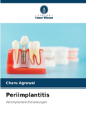 Periimplantitis