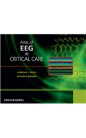Atlas of EEG in Critical Care