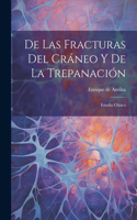 De Las Fracturas Del Cráneo Y De La Trepanación