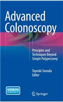 Advanced Colonoscopy: Principles and Techniques Beyond Simple Polypectomy