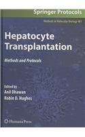 Hepatocyte Transplantation