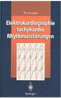 Elektrokardiographie Tachykarder Rhythmusstarungen