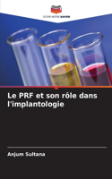 Le PRF et son rôle dans l'implantologie