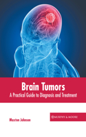 Brain Tumors: A Practical Guide to Diagnosis and Treatment
