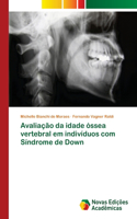 Avaliação da idade óssea vertebral em indivíduos com Síndrome de Down