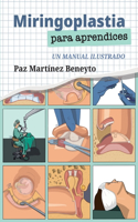 Miringoplastia para aprendices