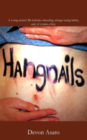 Hangnails