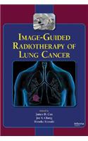 Image-Guided Radiotherapy of Lung Cancer