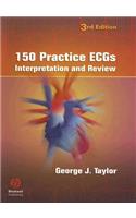 150 Practice Ecgs