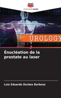 Énucléation de la prostate au laser