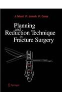 Planning and Reduction Technique in Fracture Surgery