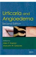 Urticaria and Angioedema