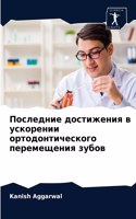Последние достижения в ускорении ортодон