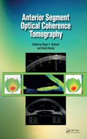 Anterior Segment Optical Coherence Tomography
