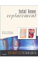 Total Knee Replacement