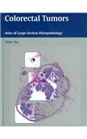 Colorectal Tumors: Atlas of Large Section Histopathology