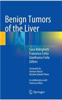 Benign Tumors of the Liver