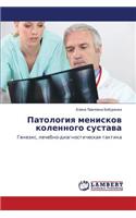 Patologiya Meniskov Kolennogo Sustava
