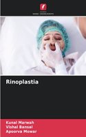 Rinoplastia