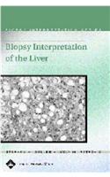 Biopsy Interpretation of the Liver