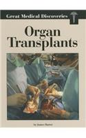 Organ Transplants