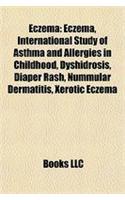 Eczema: International Study of Asthma and Allergies in Childhood, Dyshidrosis, Diaper Rash, Nummular Dermatitis, Xerotic Eczem: (English)