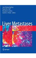 Liver Metastases