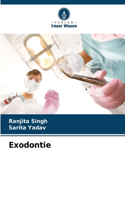 Exodontie