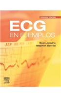 ECG En Ejemplos