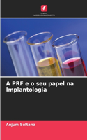 A PRF e o seu papel na Implantologia