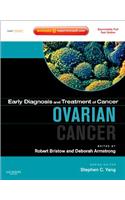 Ovarian Cancer