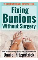Fixing Bunions Without Surgery