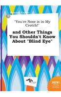 You're Nose Is in My Crotch! and Other Things You Shouldn't Know about Blind Eye