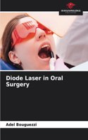 Diode Laser in Oral Surgery