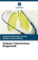 Globale Tuberkulose-Diagnostik