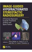 Image-Guided Hypofractionated Stereotactic Radiosurgery