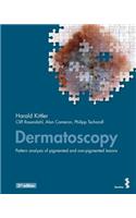 Dermatoscopy