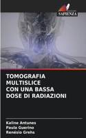 Tomografia Multislice Con Una Bassa Dose Di Radiazioni