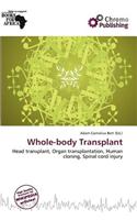Whole-Body Transplant: (English)