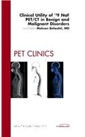 Clinical Utility of 18naf Pet/CT in Benign and Malignant Disorders, an Issue of Pet Clinics