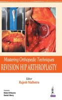 Mastering Orthopedic Techniques: Revision Hip Arthroplasty