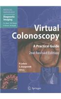 Virtual Colonoscopy