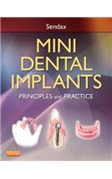 Mini Dental Implants: Principles and Practice